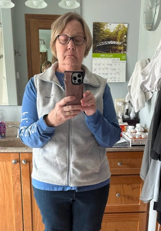 Judy S. before